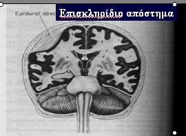 ΛΟΙΜΩΞΕΙΣ ΚΝΣ