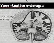 ή μηνιγγοεγκεφαλίτιδα