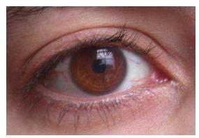 Ο ανθρώπινος οφθαλμός Τα αισθητήρια της όρασης: στον αμφιβληστροειδή (retina) 2 τύποι τέτοιων