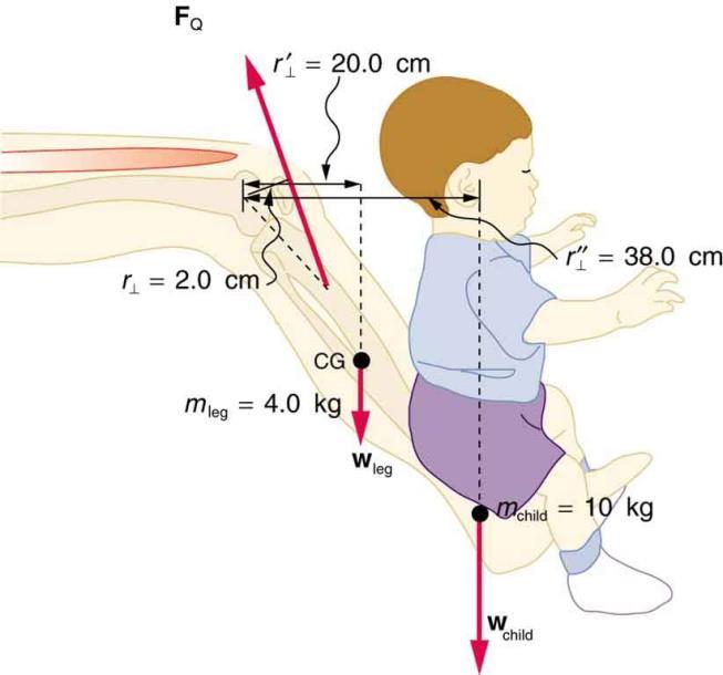 ΑΣΚΗΣΕΙΣ: ΣΥΝΘΕΤΑ ΜΟΝΤΕΛΑ Ο μηχανισμός του μοχλού: Αριθμητικό παράδειγμα 5.10β Πατέρας σηκώνει το παιδί του με το πόδι.