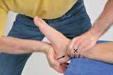 4.3 Δοκιμασίες Μετατοπιστικών Κινήσεων α) Έλξη από τη χαλαρή θέση: Ο θεραπευτής ακινητοποιεί τον αστράγαλο εντός της ποδοκνημικής, τοποθετεί το χέρι του γύρω από την πτέρνα και την απομακρύνει σε