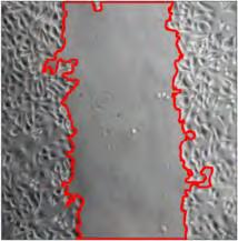 6h 12h 24h 48h Over La (Μάρτυρας) Over La & FBS deprivation Over La &