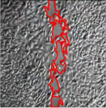 1 5 0 H 2 O 2 (5 0 0 μ M ) 1 0 0 1 0 0 5 0 5 0 0 0 h 6 h 1 2 h 2 4 h 4