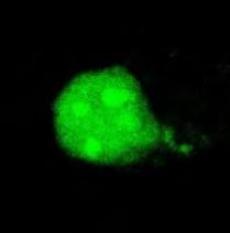 της GFP - La και η ανίχνευση της παραγόμενης πρωτεΐνης με συνεστιακή