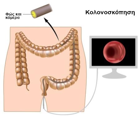 1. Κλινική εξέταση Αυτό περιλαμβάνει τη φυσική εξέταση της κοιλιάς και του ορθού*.