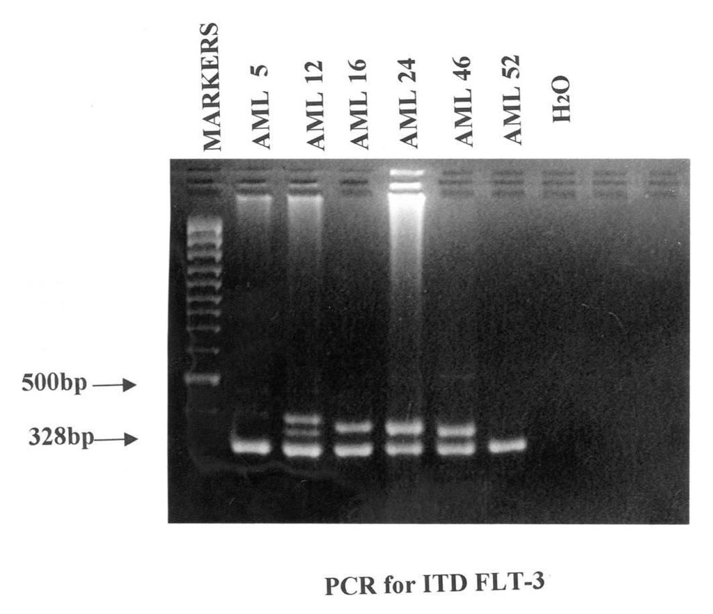 FLT3-ITD