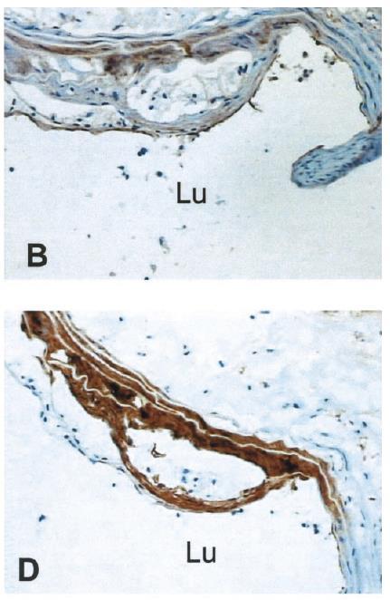 ICAM-1 VCAM-1 Bro, S et al.