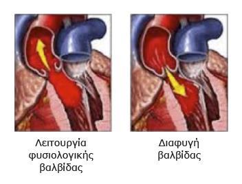 Ανεπάρκεια