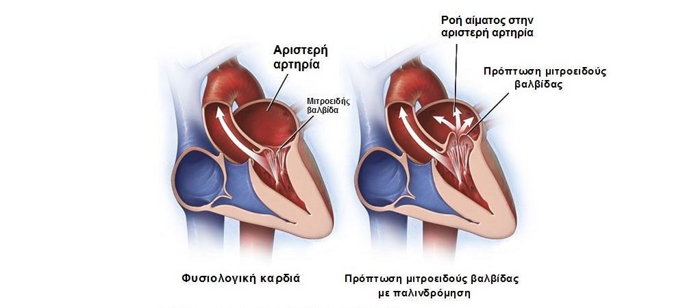 Πρόπτωση