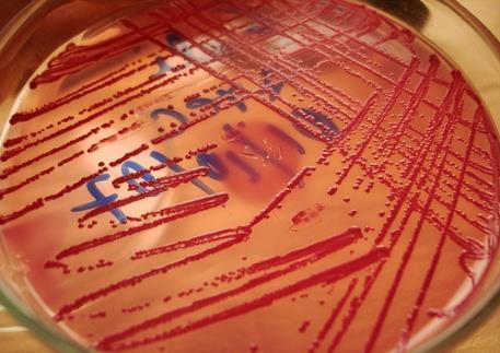 ESCHERICHIA COLI Ανήκει στην οικογένεια Enterobacteriaceae. Είναι ένα Gram-, ραβδοειδούς σχήματος κολοβακτηρίδιο.