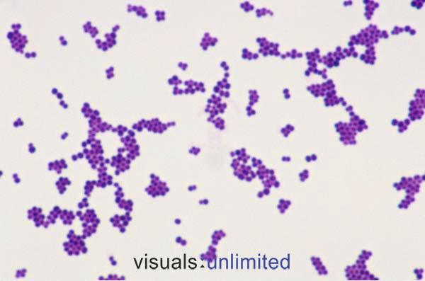 STAPHYLOCOCCUS AUREUS Το γένος Staphylococcus ανήκει στην οικογένεια Staphylococaceae.