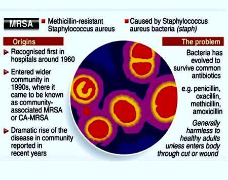 Methicillin-Resistant