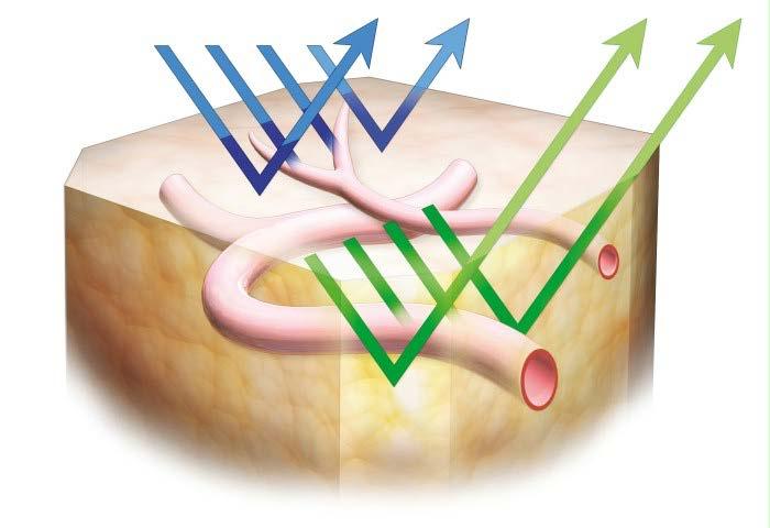 NBI Narrow-band imaging is an imaging technique for