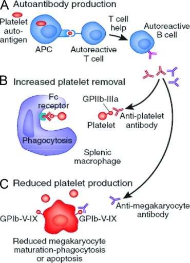 Proposed mechanism of immune dysregulation in ITP.