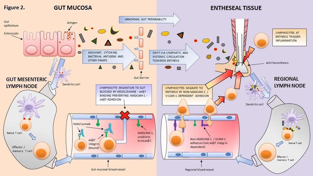 Το Vedolizumab: μια εντεροεκλεκτική αντι-ιντεγκρίνη