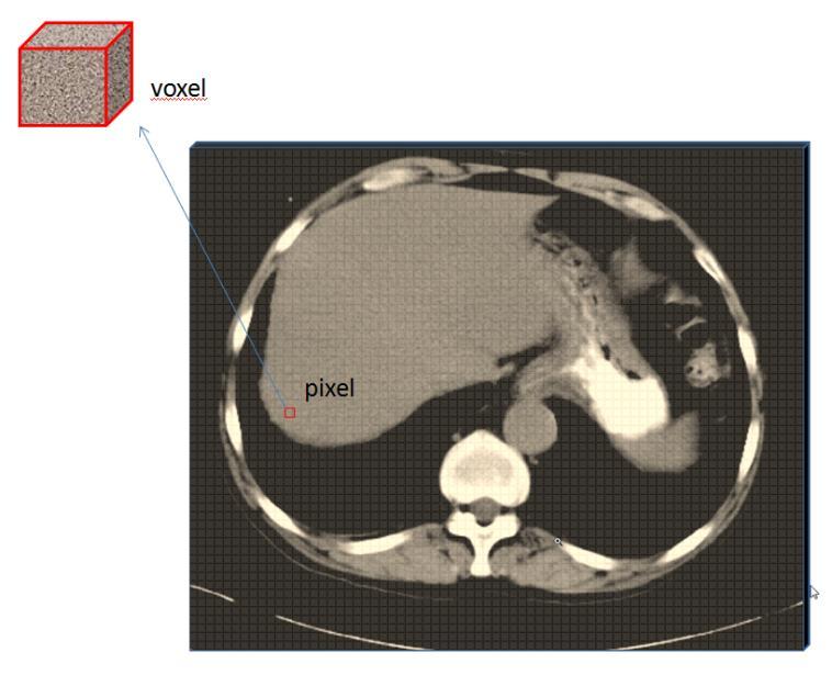 Βασικές φυσικές αρχές ΥΤΔΕ Η εικόνα ΥΤ Αντιστοιχεί σε μία φέτα (slice) του ασθενούς Η τιμή κάθε pixel της εικόνας (CT ij ) καθορίζεται από τη μέση τιμή μ των ιστών που περιλαμβάνει στο