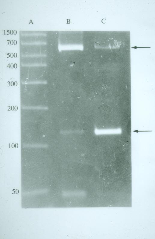 PCR