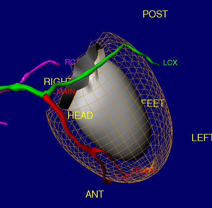 ΜΕΧΡΙ ΣΗΜΕΡΑ: Εμπορικά διαθέσιμα σύστημα SPECT/CT προσφέρονται με επιλογή έως