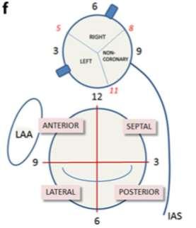 It is necessary to refer PVL in relation to anatomic reference points (f).