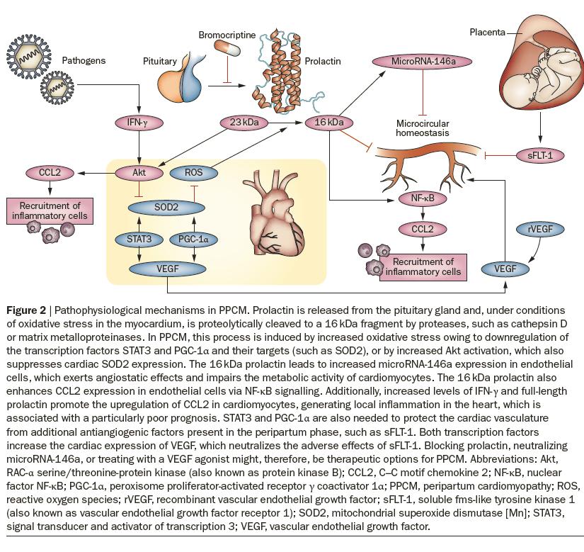 What causes PPCM? Δύο μηχανισμοί έχουν πρόσφατα προταθεί σαν πιθανές αιτίες της PPCM.