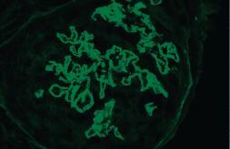 Model for the Pathogenesis of SLE Abbas, Lichtman, and Pillai.