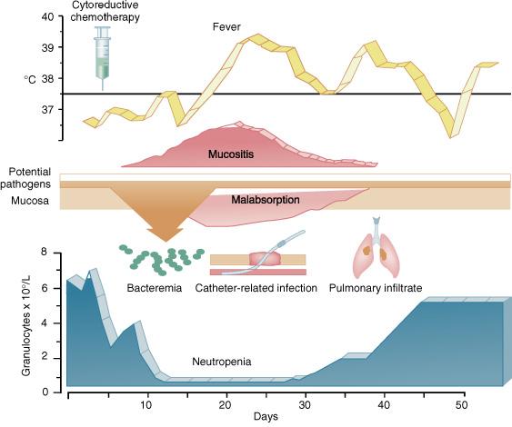 Χημειοθεραπεία πυρετός βακτηριαιμία Λοίμωξη από