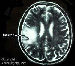 CT MRI