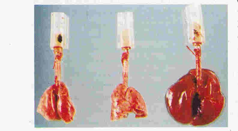 2. Ventilator Induced Lung Injury