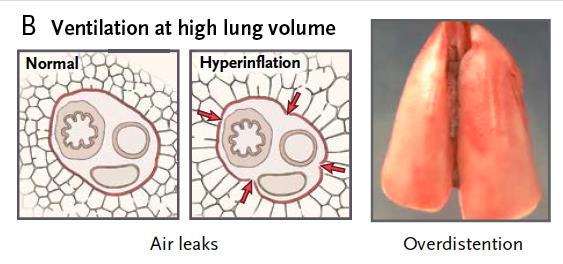 = ΔF/ΔS Lung stress =