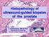 Histopathology of ultrasound-guided biopsies of the prostate. L.Kaklamanis MD,D.Phil Department of Pathology Onassis Cardiac Surgery Center