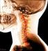 M R I ( cervical spondylo tic m yelopathy, CSM ) CSM,,,, [ 1, 2 ] 1 2