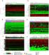 The Interaction between ERS and MicroRNAs in Tumor