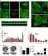 HL-60 / A. Relationship between Expression of Cell Regulatory Factor SKP2 and Drug Resistance of HL-60 / A Cells