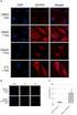 H IV-1 gp160. Ana lysis and Expression of An ti-h IV-1 Id iotyp ic An tibody. H IV 21 gp 160. , 1) Fab. gp 160