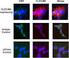 Journal of Experimental Hematology ML AHSCT