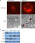 A regulatory pathway of autophagy and tumor