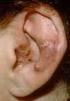 Cutaneous Diseases with Eosinophilia