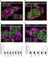 The Variances of Islet β-cell Function at Different Stages of Glucose Metabolism*