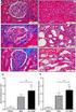 Measurement of C1 Inhibitor Function by Colorimetric Method and Its Usage in the Diagnosis of Hereditary Angioedema