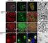 (dopamine, DA) Lewy (Lewy s body, LB)...,. 0.2%, 55, PD. 6 q25.2~q27, parkin.