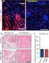 chronic kidney disease CKD nuclear transcription factor kappa B NF-κB kinases IKK IκB kappab kinases IKK proteins NF-