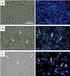 Morphological observation of protective effects of lycium barbarum polysaccharide on experimental alcoholic liver disease in rats