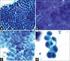 Mono-layer Cytology. Thin-layer Cytology. Liquid based Cytology