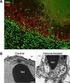 Neutrophils and thrombosis From tissue factor to neutrophil extracellular traps (NETs)