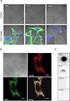 A Novel Fluorescence Assay for the Activity of Restriction Endonuclease Based on Molecular Beacon