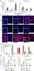 IL - 13 /IL - 18 ELISA PCR RT - PCR. IL - 13 IL - 18 mrna. 13 IL - 18 mrna IL - 13 /IL Th1 /Th2