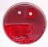 BD BBL CHROMagar Staph aureus / BBL CHROMagar MRSA II (Biplate)