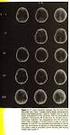 Supporting Information. Partial thioamide scan on the lipopeptaibiotic trichogin GA IV. Effects on