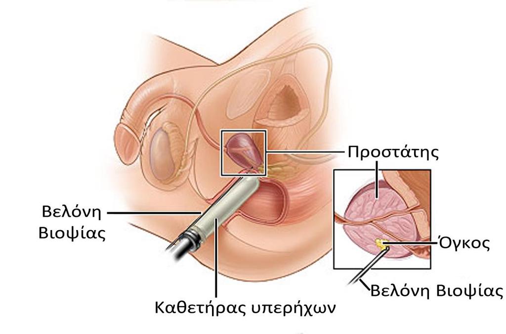 Σχήμα 11.