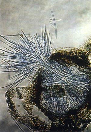 Σεπτοριάσεις (3) Septoria tritici tel. Mycosphaerella graminicola. Septoria nodorum tel. Leptosphaeria nodorum.